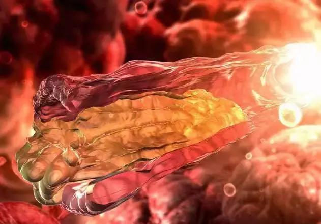 血稠的原因和症状和解决方法,血稠一定要重视