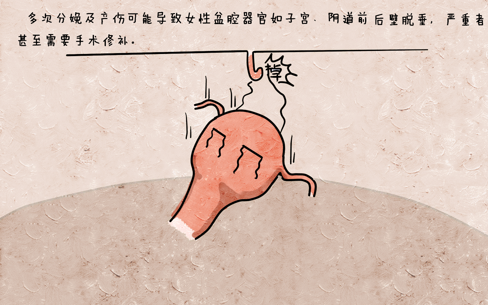 不顾身体状况一味抗拒剖腹产，坚持顺产有必要吗？