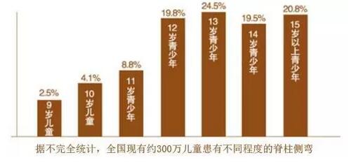 案例l3D打印支具助力青少年脊柱侧弯保守治疗
