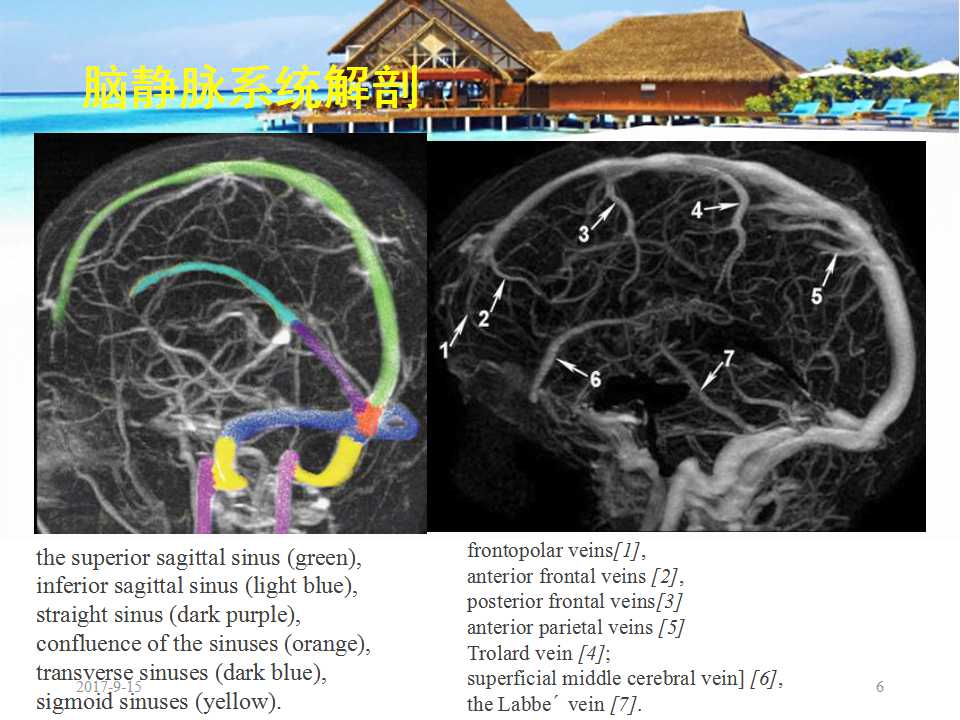 颅内静脉窦血栓形成怎么治疗,颅内静脉窦血栓形成最佳治疗方法