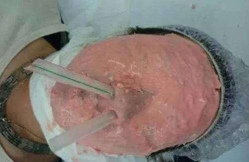 究竟是咋插进去的我出100你再重新插一次让我看看