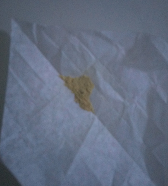 宝宝有了鹅口疮怎么办？在济南试试这种办法吧