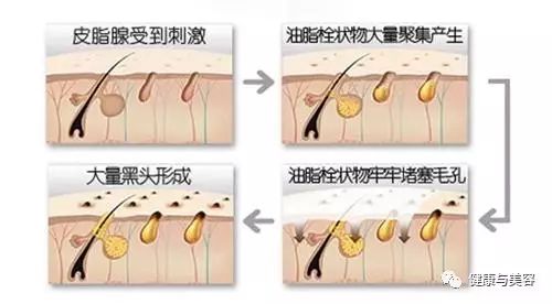 明星同款护肤品去黑头收缩毛孔,明星去黑头收缩毛孔好物推荐