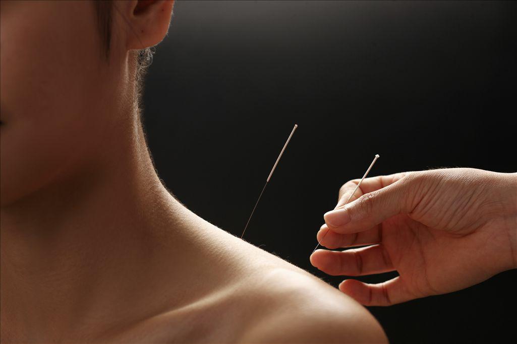 针灸真的没有副作用吗,针灸不对症有什么危害