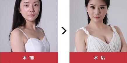 让‘它’变大你都试过什么方法