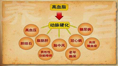腔隙性脑梗塞能做血液净化吗,预防腔隙性脑梗死