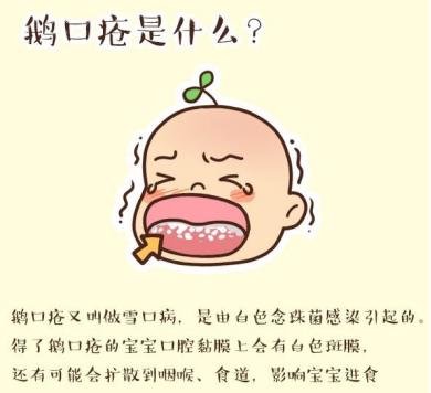 很多新手妈妈都不知道的秘密,揭秘小孩鹅口疮的4个消除方法
