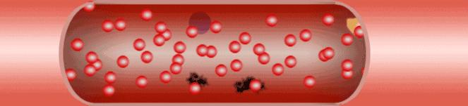 中医养生调理心脏,心脏养生秘法