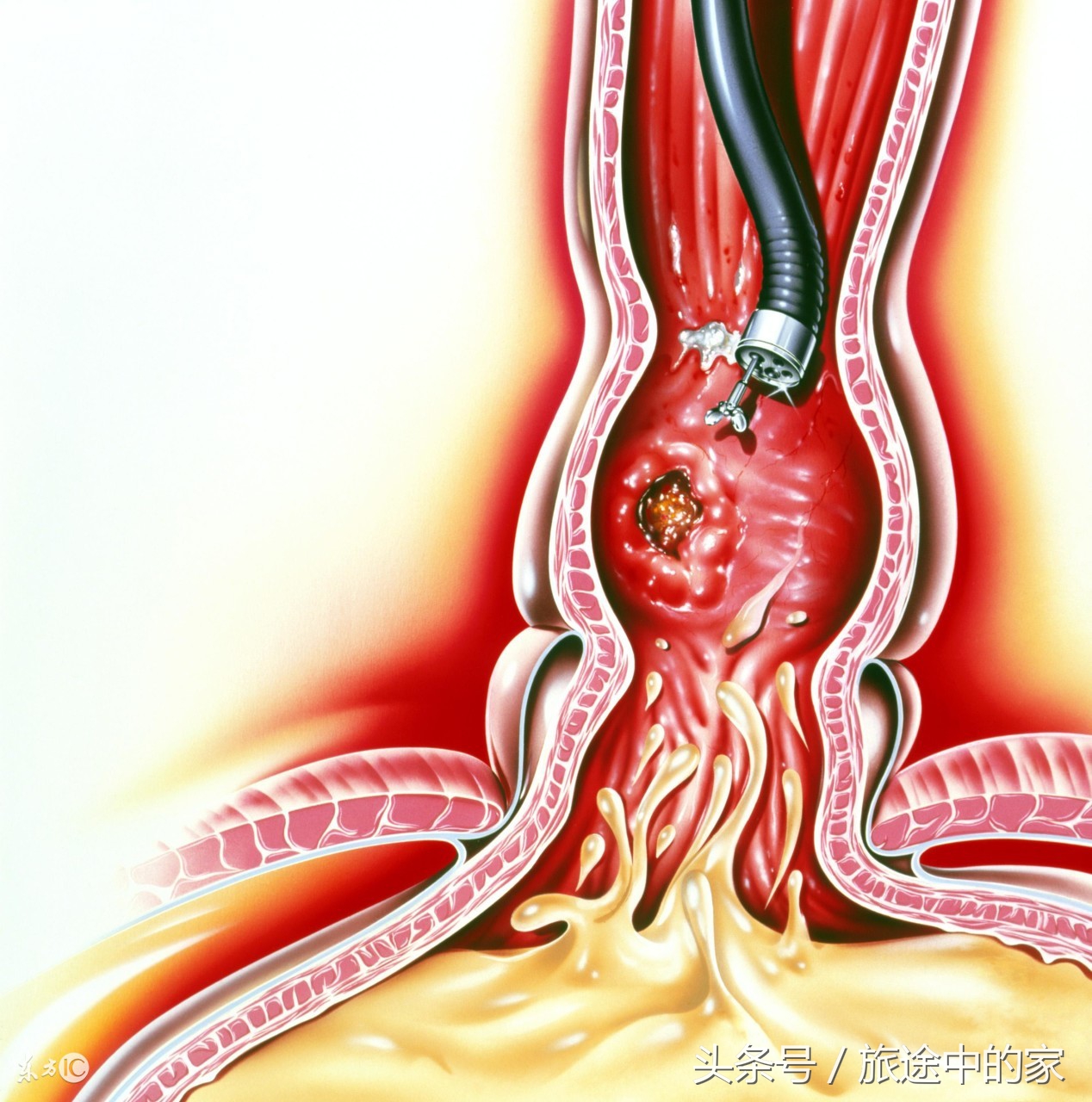 10种常见癌症早期症状知道能救命,这6种高发疾病要当心