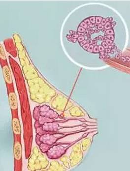 左侧A*杯罩**,右侧却疯长到D*杯罩**,12岁武汉女孩很苦恼!