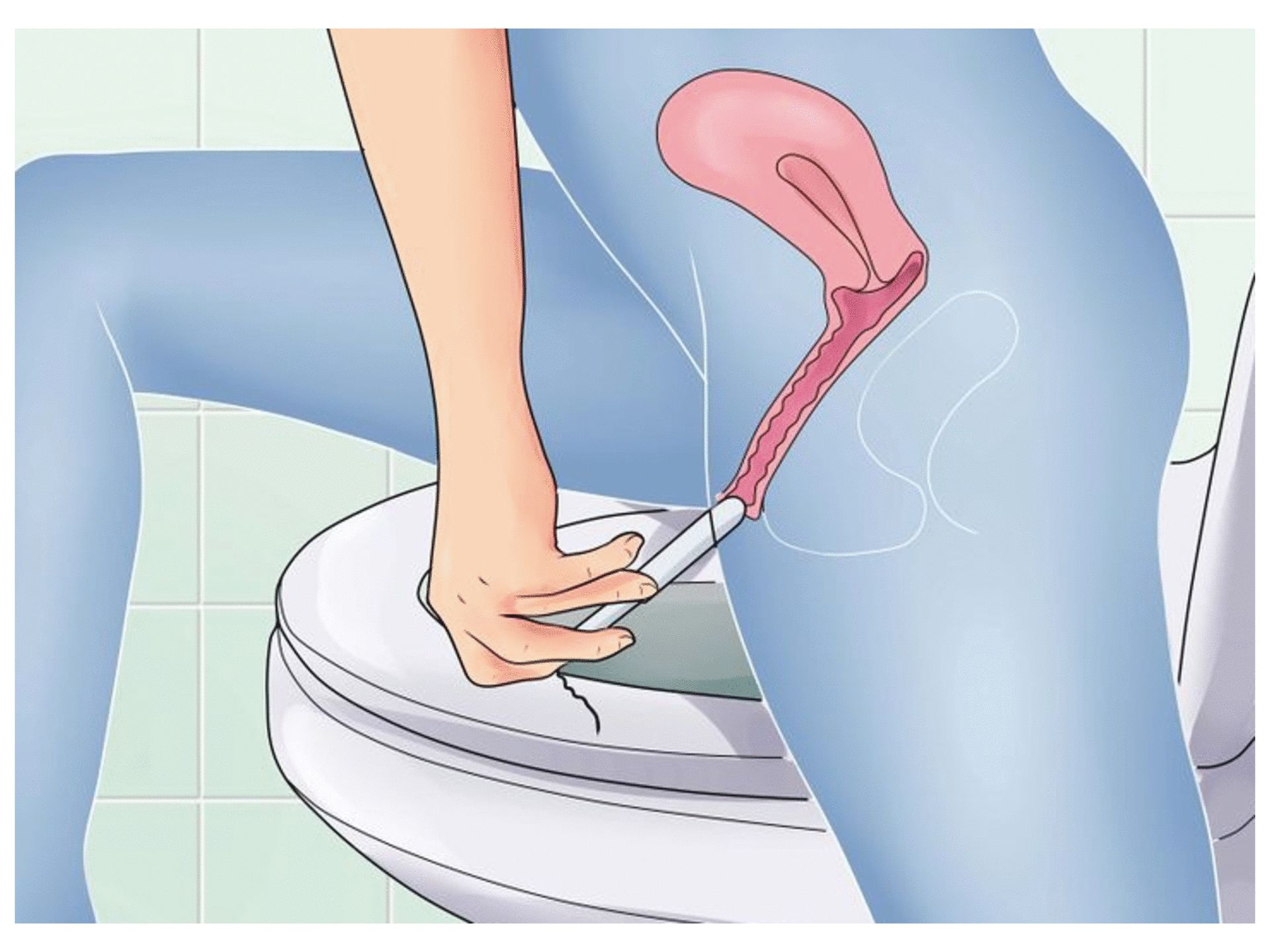 药用卫生巾真的可以防治妇科疾病？卫生棉条会破“处”？