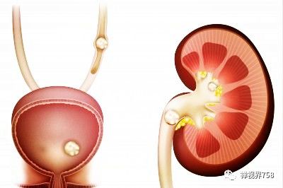 大愿谈健康——怎样通过健康六字诀来治疗我们五脏六腑上的疾病？