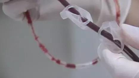 脐带血存还是捐？血液科医生最有话语权！