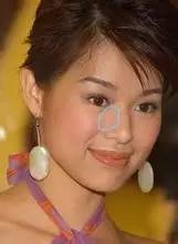 专家讲解明星微整形 (明星教你微整形)