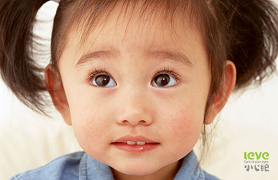 眼部瘙痒疾病的解决方案