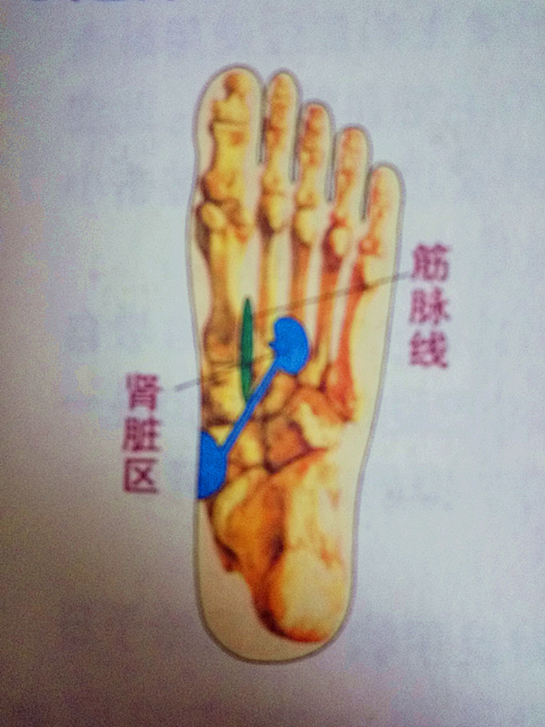 足部护理足跟痛,足跟痛足底穴位