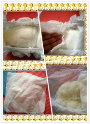 宝宝屁股长脓包需要开刀吗,宝宝屁股起脓包