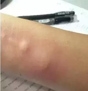 omg毛毛虫,omg吃虫子完整版