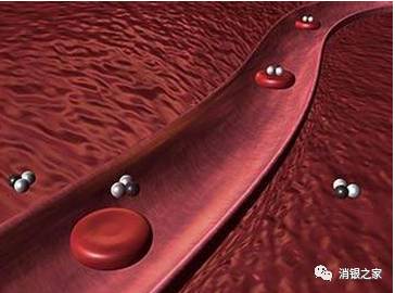 银屑病患者血液指标正常吗,银屑病血液检验报告单