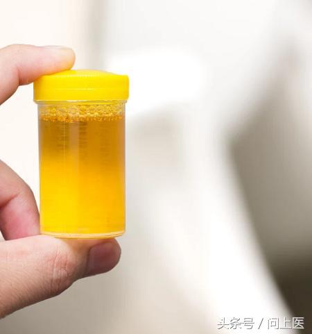 尿液、皮肤、口腔健康变化要注意！这15个癌症早期症状容易被忽视