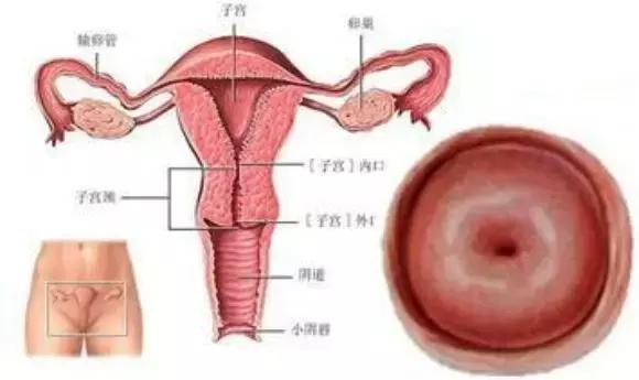 宫颈肥大要不要紧,宫颈肥大纳氏囊肿