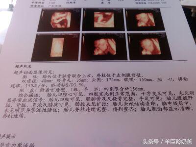 生男早生女迟是真的吗,生男生女6个传言