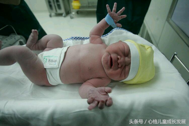 小儿脑瘫的高危因素有哪些,脑瘫发病前3位高危因素是什么