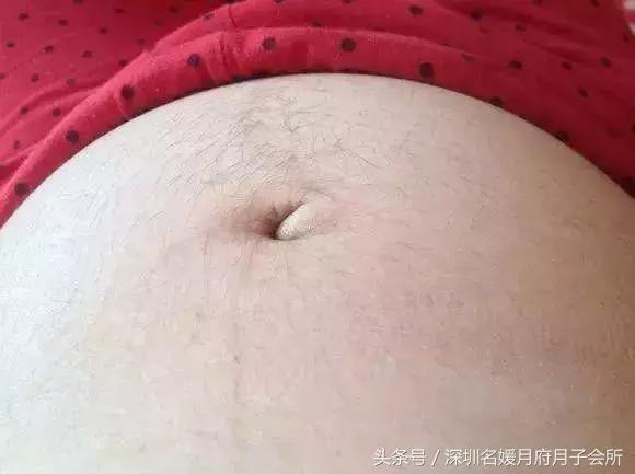 怀孕肚皮长满毛,怀男孩肚皮会长毛吗