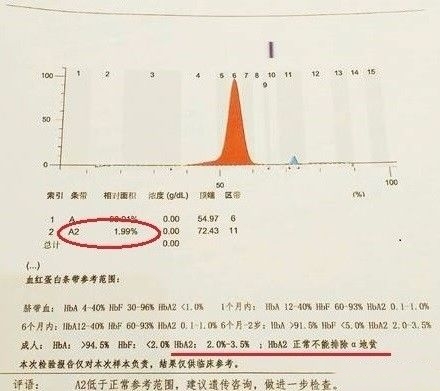 孕期地中海贫血症状和危害,地中海贫血怎样补充营养