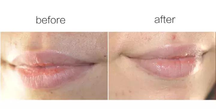 秋冬季节嘴唇干燥起皮怎么办,润唇膏夏季推荐