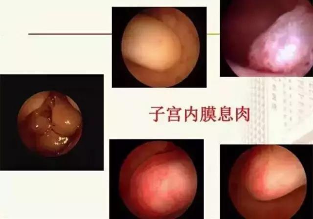 有哪些不良症状要做宫腔镜检查,一般什么情况才会做宫腔镜检查