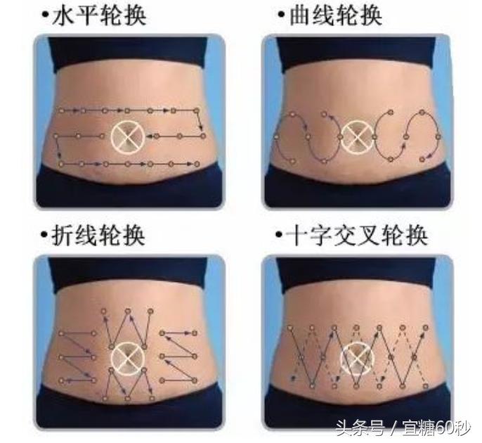 胰岛素注射用针头怎样选型号,胰岛素注射针头怎么选择