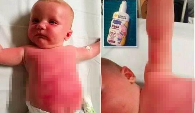 网红防晒霜事件 (澳洲防晒真的假的)