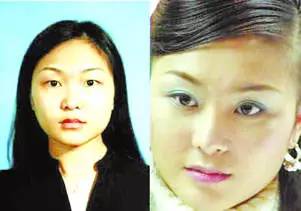 为什么明星做整形失败率更高,明星为什么不去正规整形医院