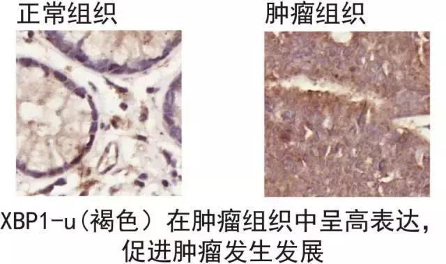 重庆研究出抗癌药物,重庆研发抗癌新药是治什么癌症