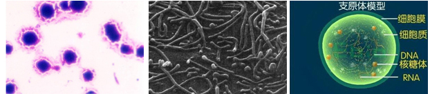 中医治疗支原体感染,支原体感染的治疗