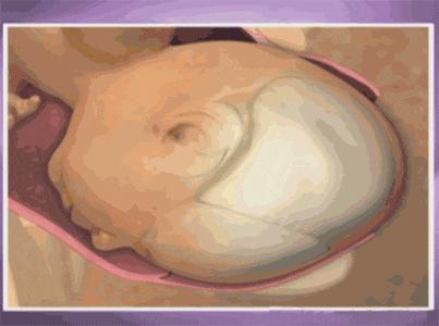 分娩过程简述20字,分娩的全部过程了解