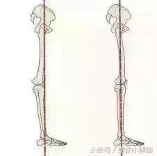 腿粗又有膝超伸该怎么改正,膝超伸为什么腿会粗