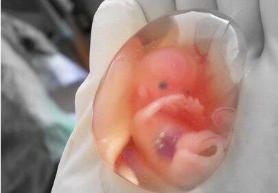 怀孕了下体出血要不要吃保胎药,刚怀孕有轻微的出血怎么保胎治疗