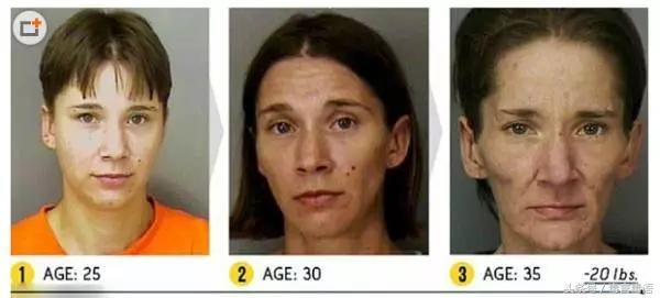 触目惊心吸毒前后真实的变化,吸毒的危害到底有多严重图片