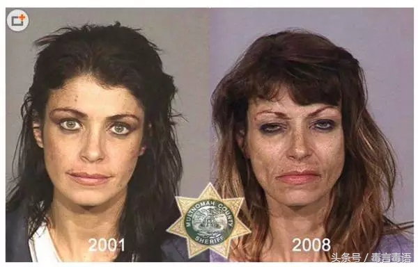 吸毒前后的变化对比,吸毒真的会毁容吗