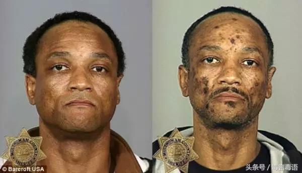 10个吸毒前后的惊人变化,吸毒的人吸毒前后对比图片