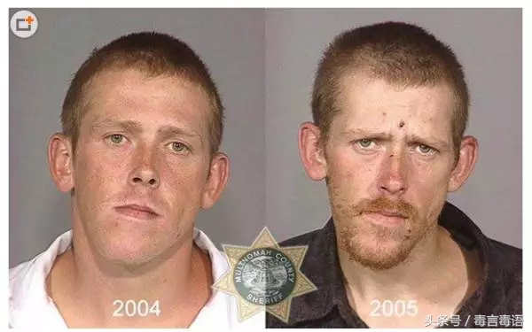 10个吸毒前后的惊人变化,吸毒的人吸毒前后对比图片