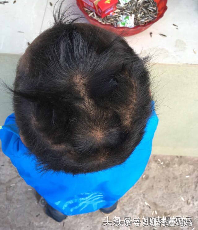 宝宝头旋儿到底有几个好?家长必须了解的秘密!