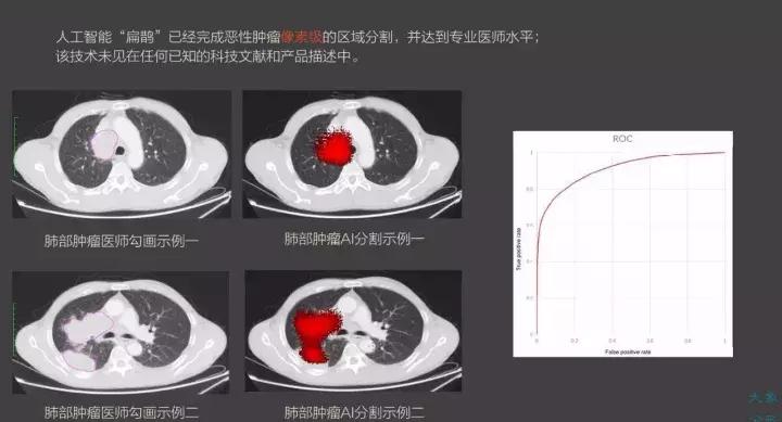 尧德中能否评上院士,马斯克脑机芯片能治疗脑瘫吗