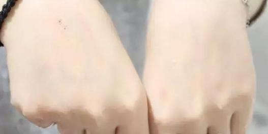 皮肤没有瑕疵适合什么护肤,不化妆的护肤推荐