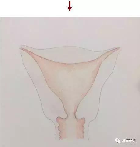 三胞胎的子宫变化,他们是三胞胎姐妹
