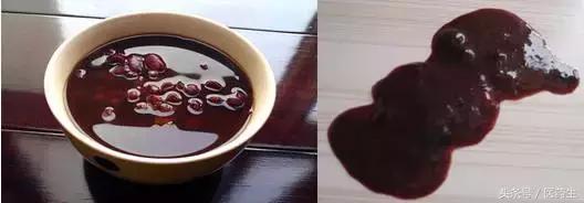 舌尖上的医疗,舌尖上的医疗篇