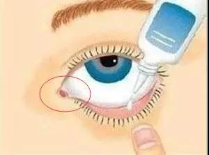 美少女眼睛突出,美少女也有黑眼圈