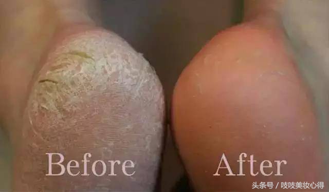 吱吱の秋季爱用物清单,每一款都好用到哭!